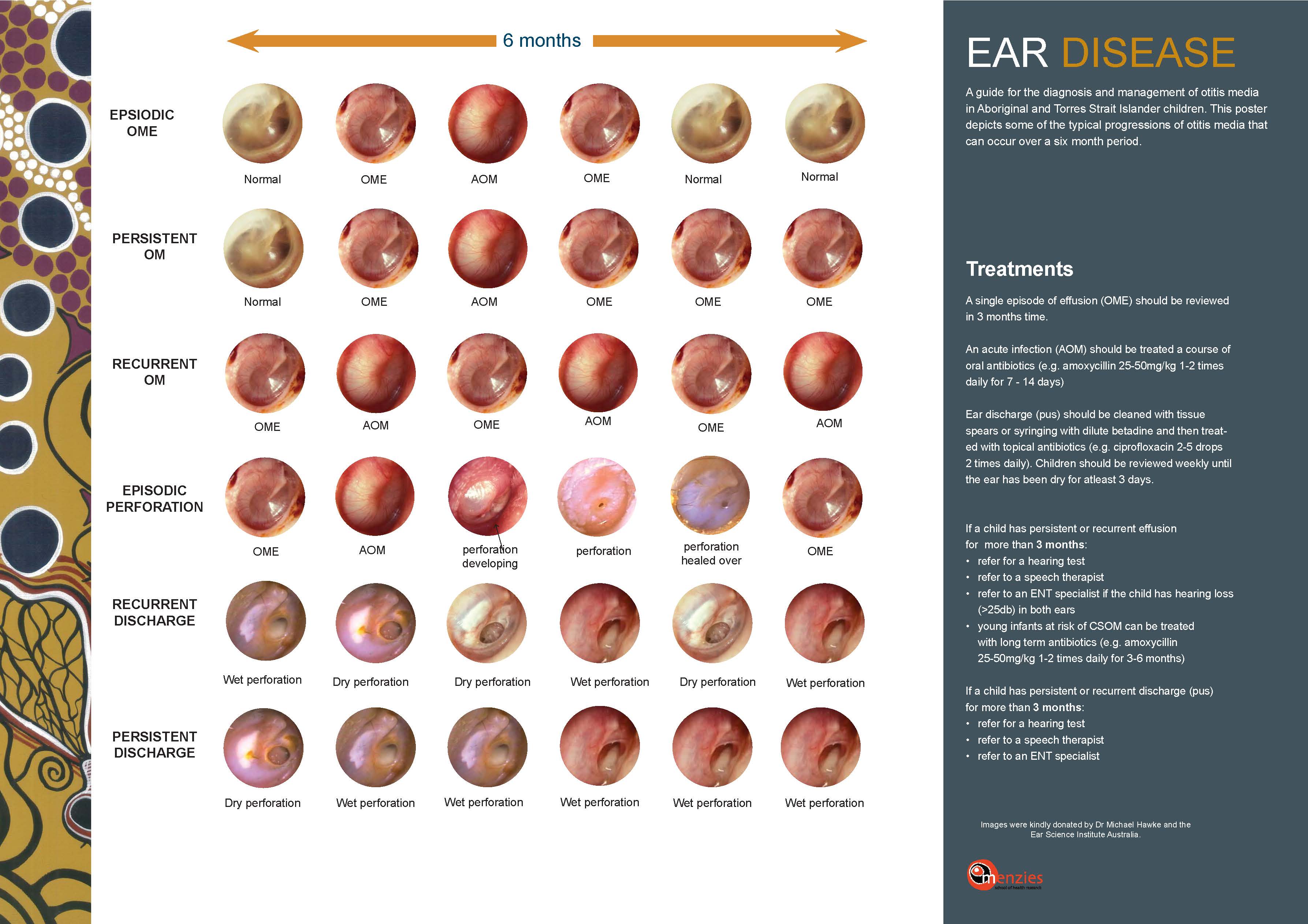 Ear disease images